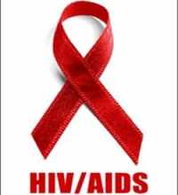 Virus dell'Hiv e Aids
