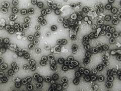 Infezione da papilloma virus sintomi, Lesioni da papilloma virus - Che cos e il papilloma virus