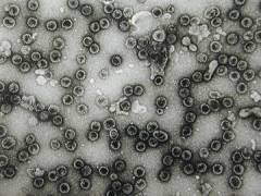 cos e il papilloma virus hpv tratamentul verucilor hpc