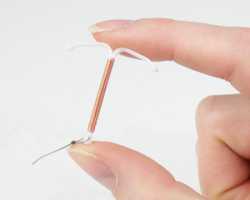Spirale IUD