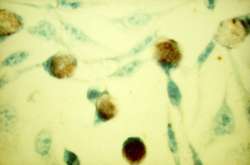 chlamydia trachomatis - clamidia